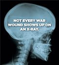 Not every war wound shows up on an Xray